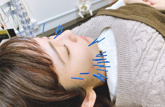 むくみ改善やリフトアップをご希望の40代女性がPRIMO鍼灸整骨へ来院されました！